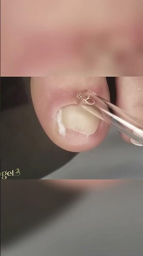 Unlock the Secret to Happy Feet Daily Tips & Tricks! 👣