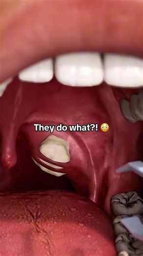 Understanding Tonsil Stones and Effective Solutions
