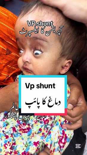 رابطہ پروفائل میں ہے #foryou #fyp #fypシ #foryoupage #medical #doctor #health #drwaheedalam