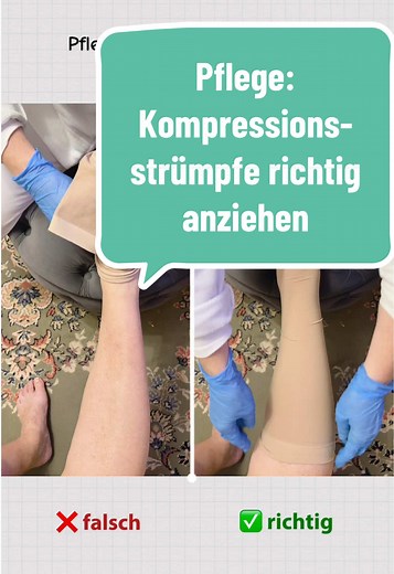 Pflegewissen: Kompressionsstrümpfe richtig anziehen 🧦 Schritt für Schritt erklärt – für Ausbildung & Praxis. . . #pflege #ausbildung #kompressionsstrümpfe #pflegefachkraft #lernen