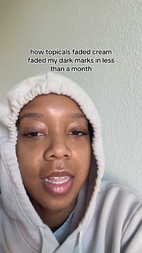 How Topicals Faded Cream Eliminated Dark Marks Quickly