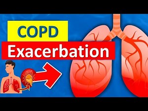 COPD Exacerbation /Management/Treatment, Symptoms,Causes, Emergency Medicine Lectures