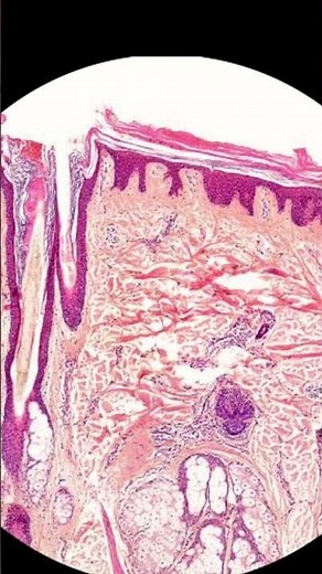 What skin looks like underthe microscope #laboratory #microscope #mls #cls #cells #epidermis #dermis
