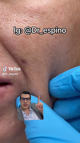Hilo tensor: Innovación en Facelifts en California y Arizona