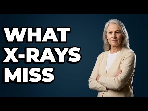 Do X-rays Show All Types of Bone Breaks?