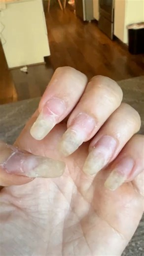 811K views · 3.4K reactions | I’ve come so far from this video  #diynailsathome #diynails #howtodonails #howtododippowdernails #diynailsupplies #nails #jellynails #dippowdernailsbeginners Diy nails at home Diy nails amazon kit How to prevent dip nails from lifting | JulieHaneline | Facebook