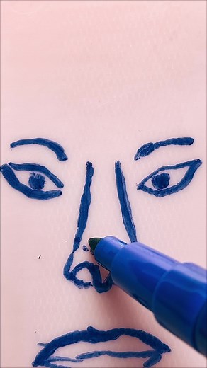 Paramedian forehead flap: incision