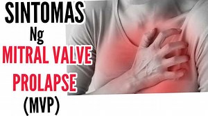 716K views · 13K reactions | Mitral Valve Prolapse (MVP): Delikado Ba? Palpitasyon at Sakit sa Dibdib ang Sintomas By Doc Willie Ong (Cardiologist-Internist) Kailangan ng 2D-Echo para ma-diagnose ang MVP. Alamin ang Gagawin: | Doc Liza Ramoso-Ong | Facebook