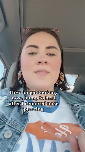 Healing Process of a Nose Piercing Bump Over Time