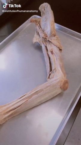 GOLFERS ELBOW!! Subscribe to us on YouTube! #scienceismagic #science #todaywelearned #human #anatomy #mindblown #muscles #elbow