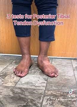 3 tests for Posterior Tibial Tendon Dysfunction