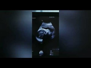 Gender Affirmation Subliminal: Get Pregnant & Have a Female Body