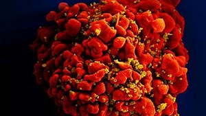 CDC called in to investigate HIV surges in the Cincinnati region