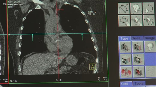 Virginia improves in lung cancer outcomes but lags in early detection and testing access