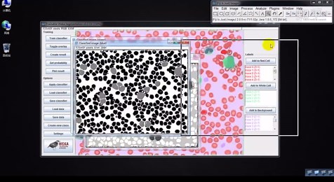 ImageJ教程视频-机器学习自动细胞计数