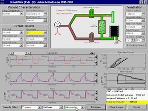Exhausted CO2 Absorbent - Depiction of gas flow pattern in the anesthesia breathing system