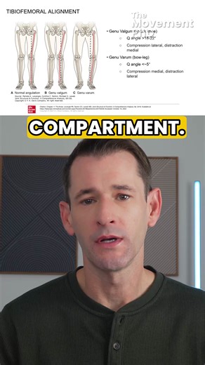 Genu Valgum and Genu Varum: Compression and Distraction Forces at the Knee | The Movement PhD