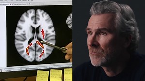 PSA raises awareness on concussions and intimate partner violence