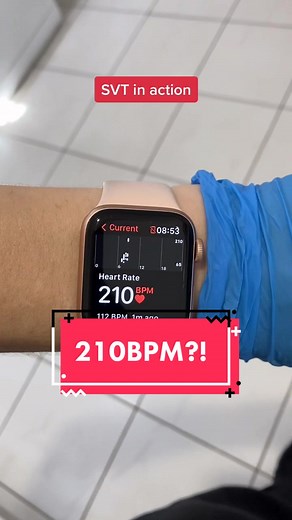 Heart Attack Simulation: Understanding SVT and Cardiac Conditions