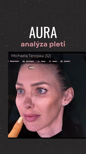MDDr. Michaela Terzijská (Šedová) on Instagram: "✨ Aura. Švýcarský zobrazovací přístroj, který vidí víc než zrcadlo. Ne, tohle není filtr. A už vůbec ne odhad. Aura Imaging System je špičkový švýcarský přístroj, který detailně analyzuje pleť do hloubky. Ukáže to, co pouhým okem nevidíme: • pigmentace • cévky • strukturu pleti • známky stárnutí, které teprve přijdou 👉 Díky tomu neléčíme naslepo. 👉 Každý plán je přesný, individuální a dává smysl. Protože hezká pleť není o trendech. Je o správném