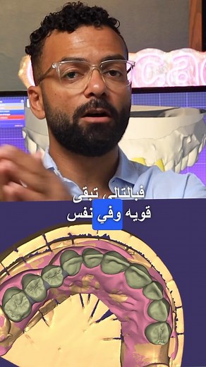 42K views · 714 reactions | Cut-back meaning what ??? . . . . #exocad #exocadexpert #digitaldentures #smile #smiledesign #smilemakeover #veneers #veneer #molar #aethetic #emax #emaxpress #dentist #dentista #dentistry #dentalphotography #dentalcare #dentalclinic #dentalimplants #art | Mostafa Salah | Facebook