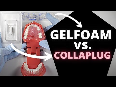Collaplug® vs. Gel Foam | OnlineExodontia.com