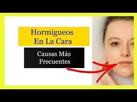 Hormigueo En La Cara【Descubre Porque Te Hormiguea La Cara】