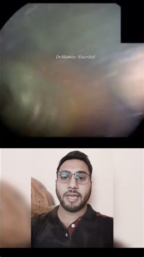 Baby ko Pregnancy Me Directly Dekhna | Fetoscopy in Pregnancy