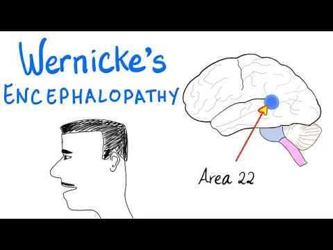 Wernicke's Aphasia (Fluent Aphasia) - Neurology
