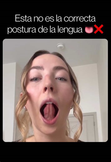 El hábito más importante… No es la nutrición. No es el sueño. 🛏️ Y no es el deporte. Es la postura de la lengua. 👅 Suena increíble, pero incluso en adultos la postura de la lengua determina el crecimiento facial, la forma del rostro y la alineación de los dientes 🦷 porque tus dientes no “reposan al azar”, reposan en un balance muscular entre la lengua, los labios 👄 las mejillas y toda la fascia alrededor de estos tejidos. Si mantienes la lengua baja, o solo subes la punta y respiras por la b