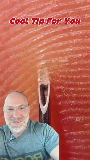 Effective Splinter Removal Techniques Using a Needle