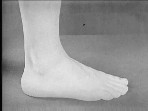 Foot Health Clinic: Problems, Treatments & Solutions