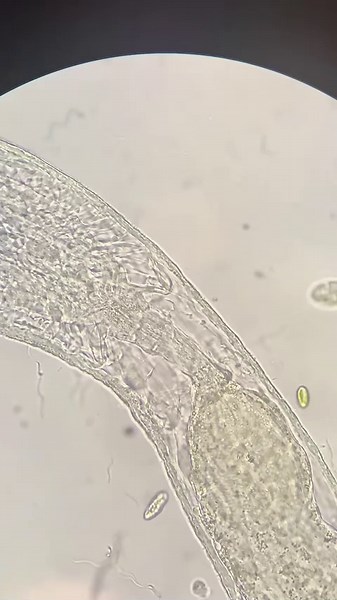 Microscopic Marvels: See Annelids Wiggle Like Never Before