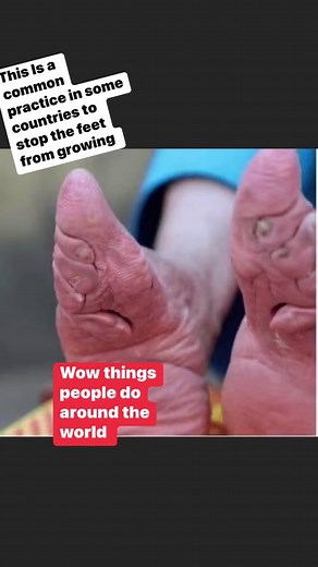 2.8K reactions · 1.4K shares | Wow, check these feet out bazaar to achieve small feet they are squeezed in little pointy shoes to keep your feet from growing that didn’t work  viral #Yvette #Positive #Happy #Feet #BadFeet #DamageFeet #GoodVibes #Happy#Positive #Inspiration #Inspirational #over50andfabulous#bazaar #Vivian’sAdventures #VIPStyles | Vivian Woodson-Hotchkins | Facebook