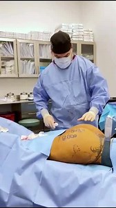 Aveli Cellulite Treatment | Elite Plastic Surgery