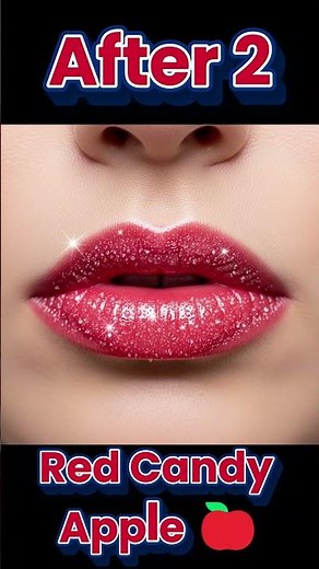 Candy Lips | Viral Lip Transformation 🍭 Before After Glow Up 💄👄 #LipTrendz