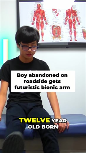 $1 vs $1,000,000,000 Futuristic Tech! Selecionar Clipes originais (27) #1 Abandoned Boy Gets $25K Bionic Arm: Superhero Moment! PRÉVIA EM BAIXA RESOLUÇÃO 00:00 01:34 99 /100 ￼ Publicar nas redes sociais ￼Baixar em HD Exportar XML￼Editar clipe ￼Gancho de IA ￼Aprimorar a fala 9:16 Análise de cena Apenas transcrição [01:42-01:54] twelve year old born without an arm and was sadly abandoned on the side of the road This is what Kai thinks he's about to get This is hard And he has no idea he's in a fak