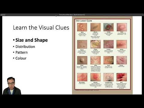 Rash Decisions- Paediatric Rashes Part 1. Introduction to Paediatric Dermatology