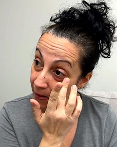 🎊 SAVE 20% 🎊 Use code 20FORME to get 20% off our Plexaderm Rapid Reduction Serum trial! Get younger-looking skin in minutes with Plexaderm Rapid Reduction Serum! This serum is specifically designed to reduce the appearance of under eye puffiness and wrinkles, smooth out crow's feet, and minimize dark circles for an instantly more youthful look! | Plexaderm Skincare