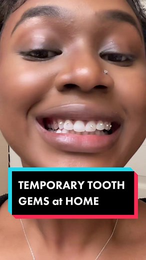 How I do my temporary tooth gens at home 😁