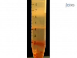 Neutrophil Extracellular Traps: How to Generate and Visualize Them