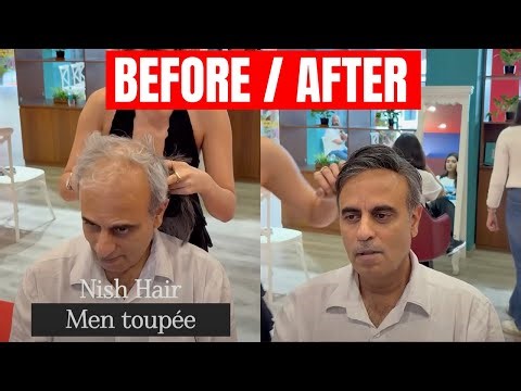 Watch This Balding Guy Transform with a Hair System! LaVivid Hair