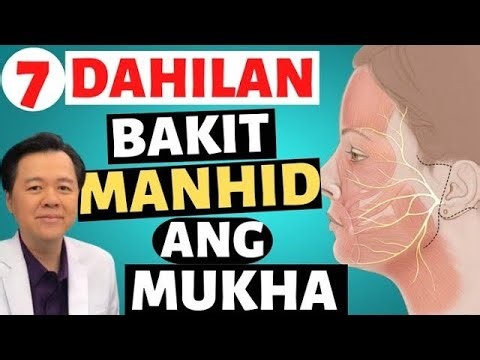 7 Dahilan Bakit Manhid ang Mukha. - By Doc Willie Ong