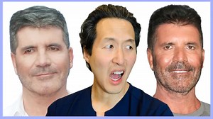 What happened to Simon Cowell's face? Doctor reacts to Simon's plastic surgery!