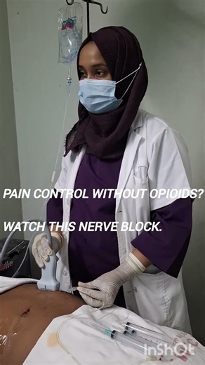 USG ESP Block regional for postoperative pain.#anesthesia #doctorlife #regionalanesthesia #espblock