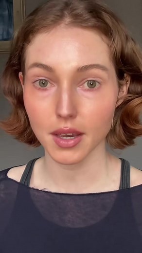 3.6K views · 21 reactions | While it is possible that filler may be...