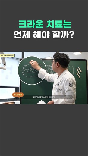 레진·인레이로 안 되는 치아 특징