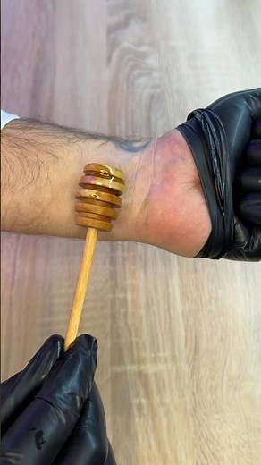 Как узнать есть ли у тебя аллергия на мёд?