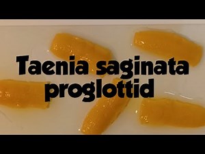 Taenia saginata Proglottids: Identification & Morphology (Parasitology)