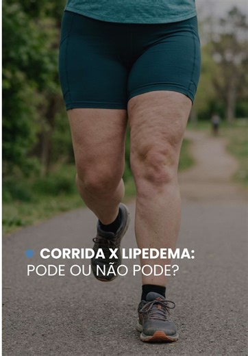 Correr com lipedema: é possível ou é um risco? A resposta é sim, mas com uma estratégia por trás. A corrida é um exercício de alto impacto e, para que ela seja uma aliada da circulação e não uma vilã da inflamação, o corpo precisa de base. Fortalecimento muscular específico e preparo articular são os pilares que permitem que você corra sem sobrecarregar os tecidos. E você, já sentiu desconforto ao tentar correr ou faz parte do time que não abre mão do asfalto?